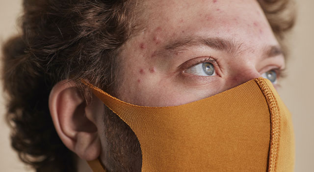 Teen with severe acne wearing mask